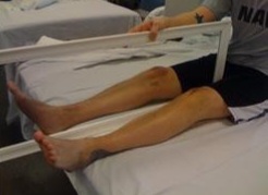 Зеркальная терапия